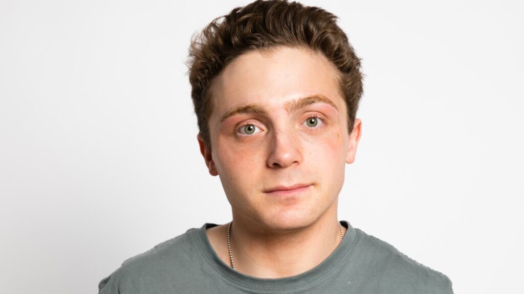 TikTok Comedian Jake Shane, aka Octopusslover8, Signs With WME